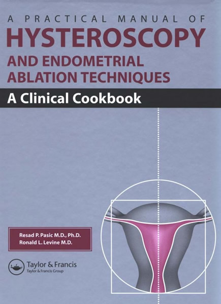 Hysteroscopy and Endometrial Ablation Techniques